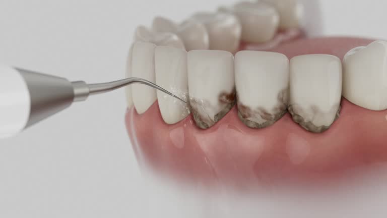 Reliable Dental contractor in Hartford, MI by Dentist Open Now